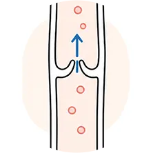 정상 판막 일러스트